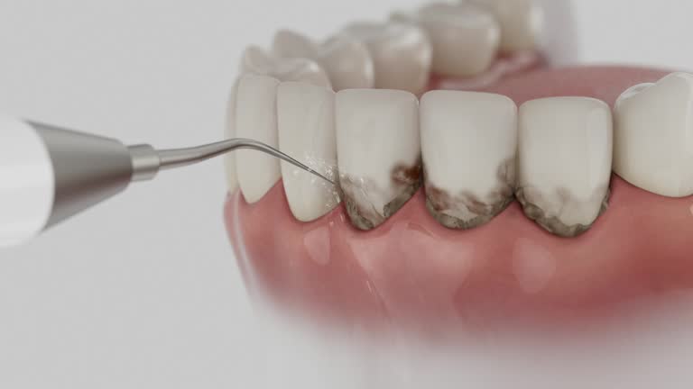Trusted Teeth Cleaning And Checkup service in Akron, PA - Dentist Open Now